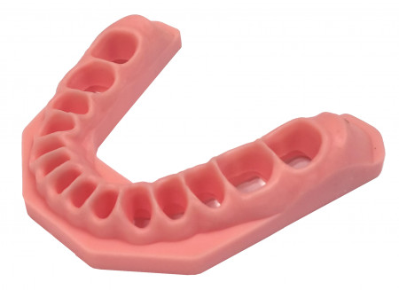 Frasaco gingiva onderkaak st