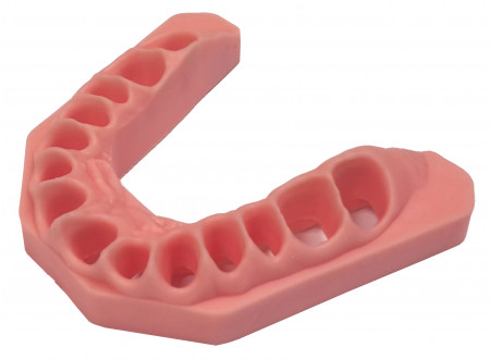Frasaco gingiva bovenkaak st