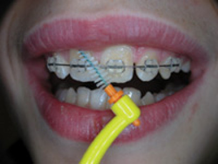 Pic-Brush intro