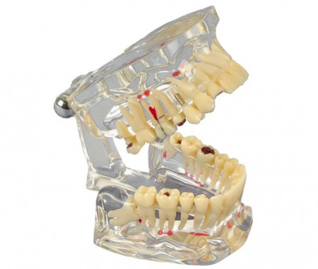 H&w studiemodel transparant de luxe st