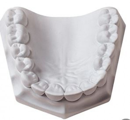 orthodontic stone (superwit) 15kg