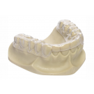 Dreve Kombiplast 120x4MM Transparant 10st.