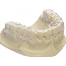 Dreve Kombiplast 125x3MM Transparant 10st.