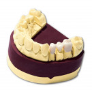 Dentona esthetic evolution elfenb 25
