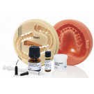 ivotion bond 10        kit