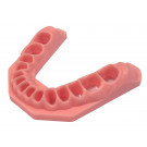 Frasaco gingiva onderkaak st